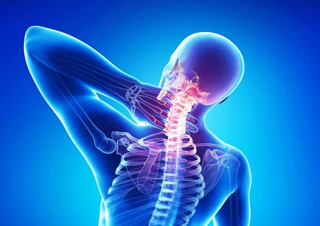 a osteocondrose é unha enfermidade da columna vertebral