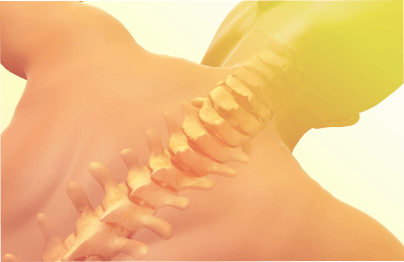 osteocondrose da columna vertebral