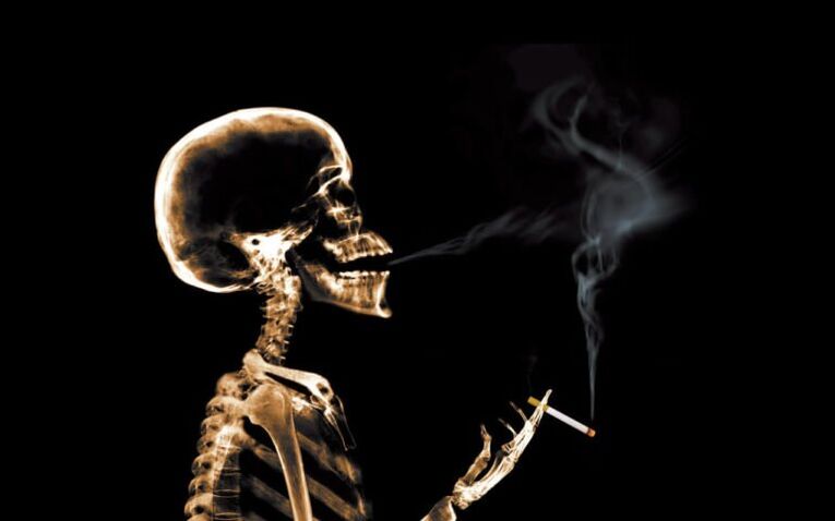 fumar como causa de dor nas costas na zona dos omóplatos
