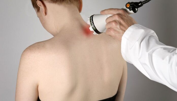 terapia láser para osteocondrose cervical